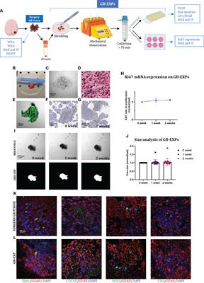 Metabolic-imaging of human glioblastoma live tumors: A new precision-medicine approach to predict tumor treatment response early